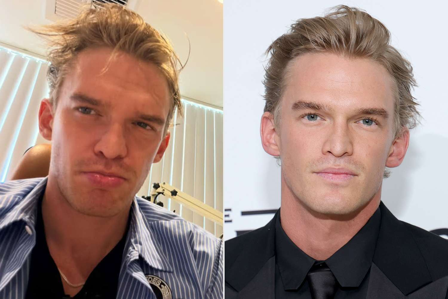 Cody Simpson Forced Into Silence After Vocal Cord Hemorrhage — His Comeback Hits a Hiccup